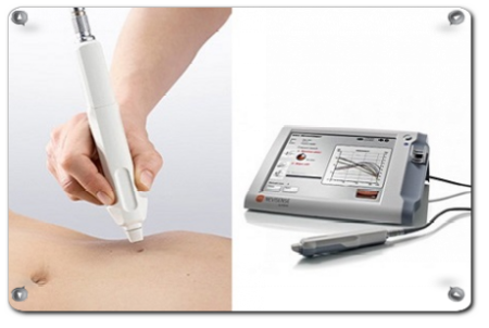 Detecting Early-Stage Melanoma and Moles